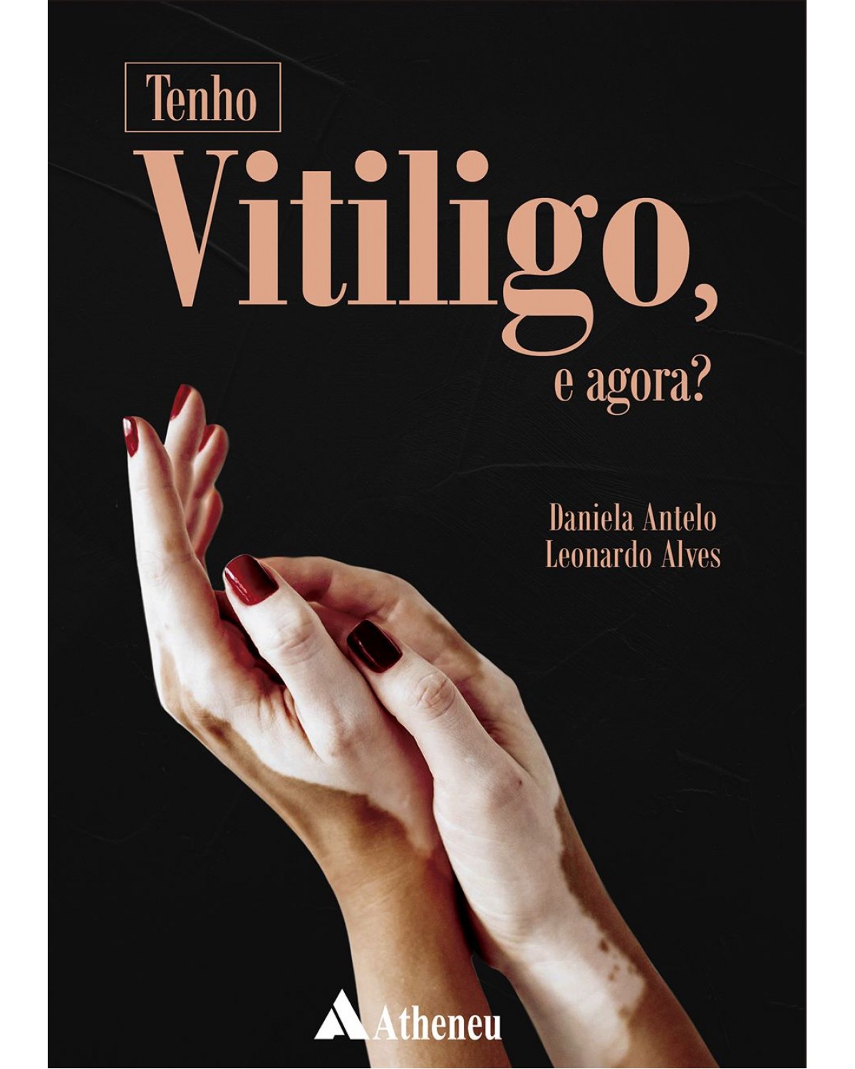 Tenho vitiligo, e agora? - 1ª Edição | 2019