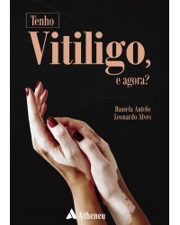 Tenho vitiligo, e agora? - 1ª Edição | 2019